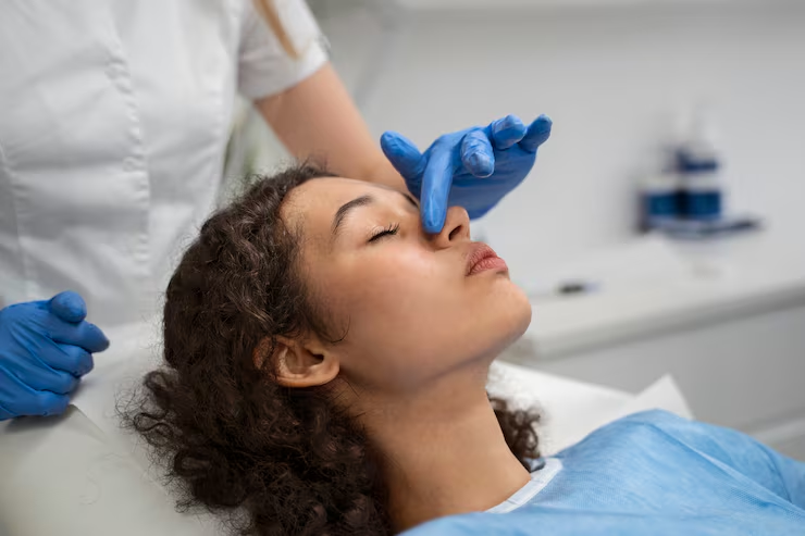 Nose Filler London: The Consultation Questions That Lead to More Natural-Looking Results