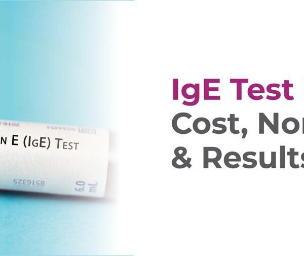 IgE Test in India: Cost, Normal Range & Results