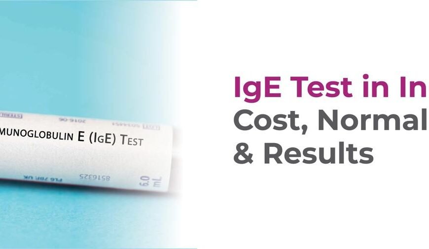 IgE Test in India: Cost, Normal Range & Results